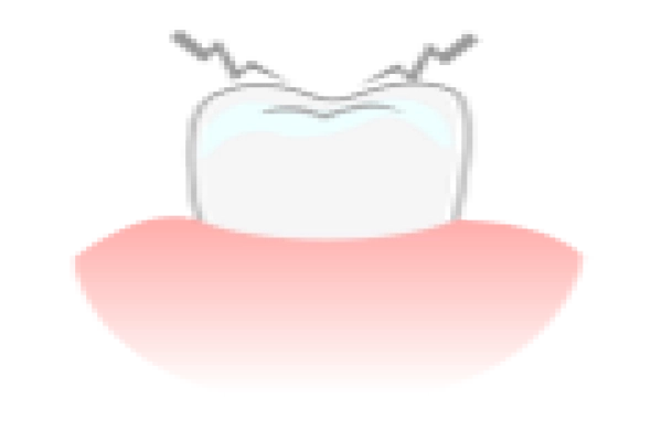 歯がしみるのイメージ写真