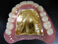 ゴールド（白金加金）床義歯